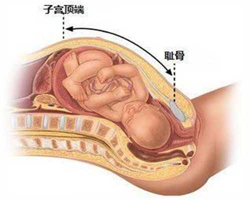 广州代生孩子的女人怎么找_治不孕不育 “秘方”