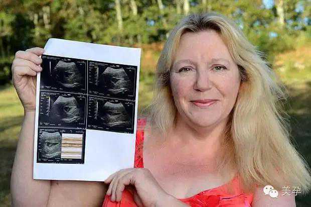 英代孕妈妈：连生15胎 享受怀孕？